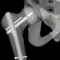 Parasolid Customers - CAE and Analysis Parasolid Customers - CAE and Analysis